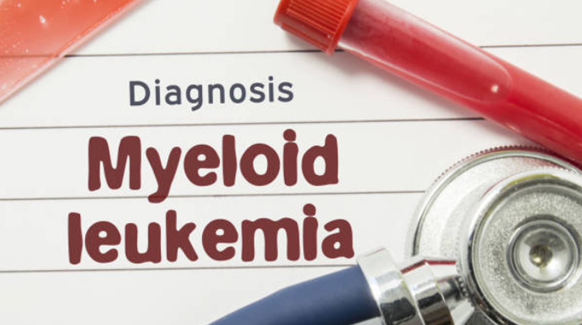 Acute Myeloid Leukemia Symptoms, Signs, Causes, And Treatments